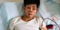 INSANIDADE: Jovem vende rim para comprar iPhone e fica acamado após cirurgia clandestina - Foto: Divulgação
