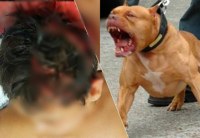 Garotinha de apenas 02 anos é violentamente atacada por cadela pit bull da família e passa por cirur - Foto: Ilustrativa