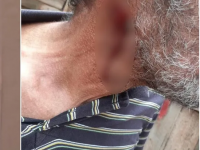 Homem corta própria garganta, é salvo por cirurgia rápida em Hospital de Vilhena - Foto: Ilustrativa