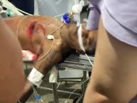 Morre foragido baleado em tiroteio com o BPTAR  - VÍDEO - Foto: Reprodução internet