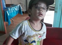 Criança de três anos morre asfixiada após se engasgar com pipoca - VEJA MAIS - Foto: Reprodução Jaruonline