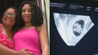 Jovem descobre que está grávida de quíntuplos e chega a passar mal durante ultrassom - Foto: Divulgação
